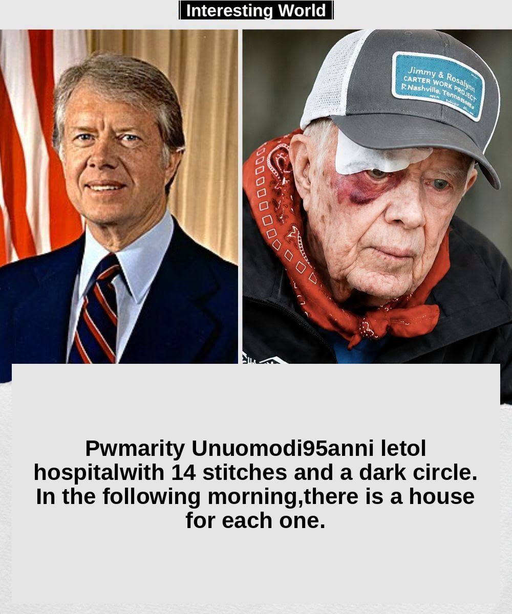He was 95 years old, a black eye and 14 points on the forehead. But Jimmy Carter still had a project to complete.